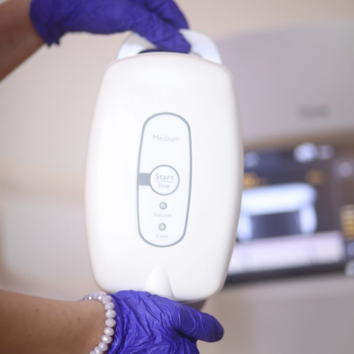 La cryolipolyse détruit la graisse localisée à travers le froid, technique d’amincissement utilisée en médecine esthétique pour lutter contre les amas de graisse localisés ou qui persistent après un régime conduit. La cryolipolyse est utilisée sur différentes zones du corps : le ventre, les poignées d’amour, les cuisses, le double menton.